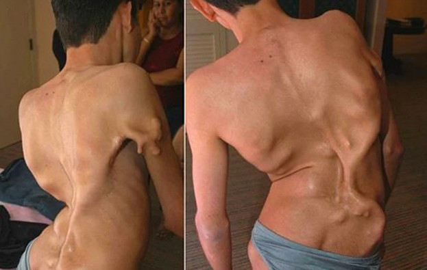 Bu hastalıkların gerçek olduğuna inanmak zor! - Resim: 4