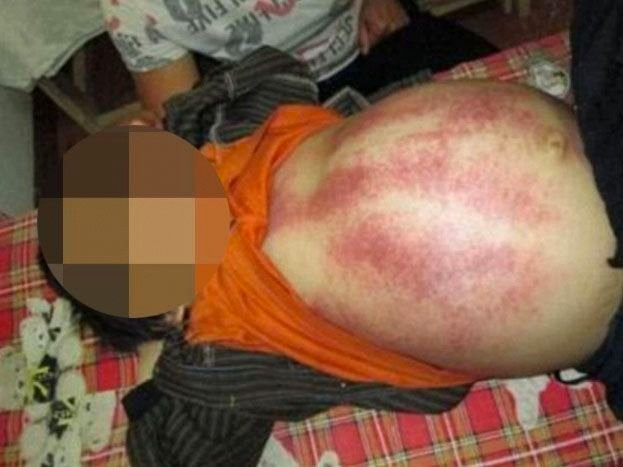 Döverek tedavi ediyorum dedi 7 yaşındaki çocuğu öldürdü! - Resim: 2