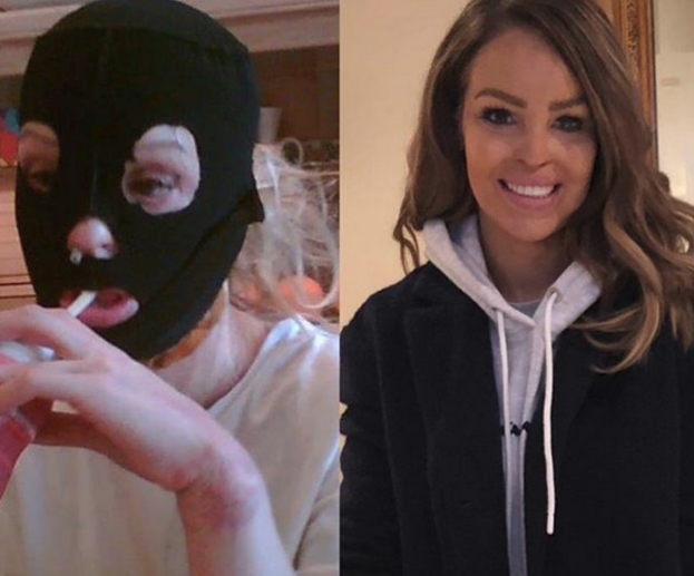 Eski sevgilisi tecavüz edip yüzüne asit fırlattı! Kadın bambaşka biri oldu - Resim: 4