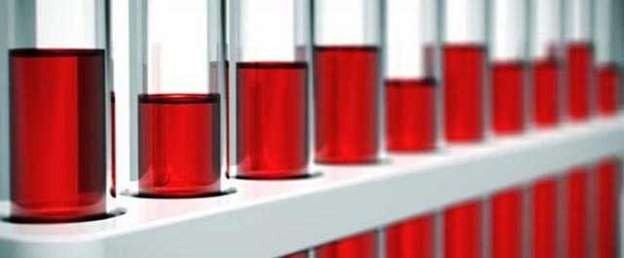 Kan grubu '0' olanlarda kalp krizi daha düşük - Resim: 4