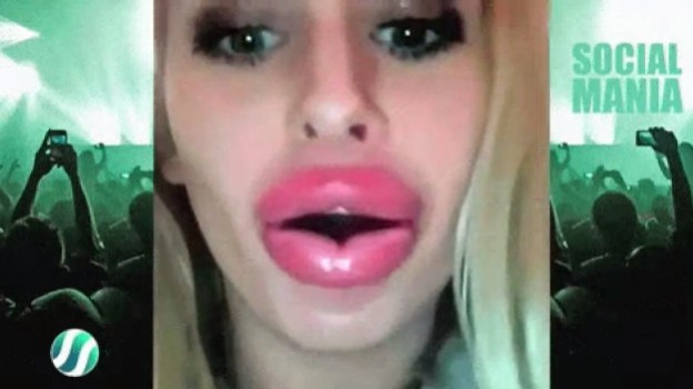 Yok artık! Vakumla dudak büyütüyorlar! - Resim: 2