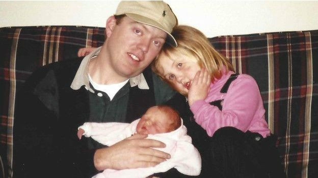 En başarılı yüz nakli yapıldı - Resim: 1