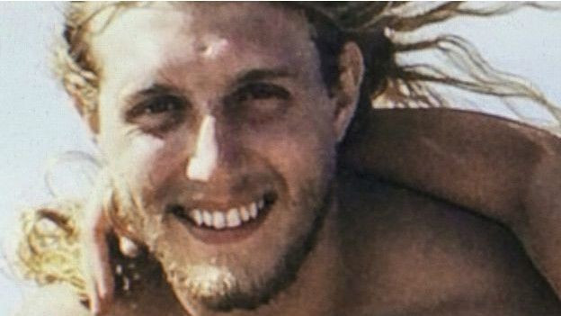 En başarılı yüz nakli yapıldı - Resim: 2