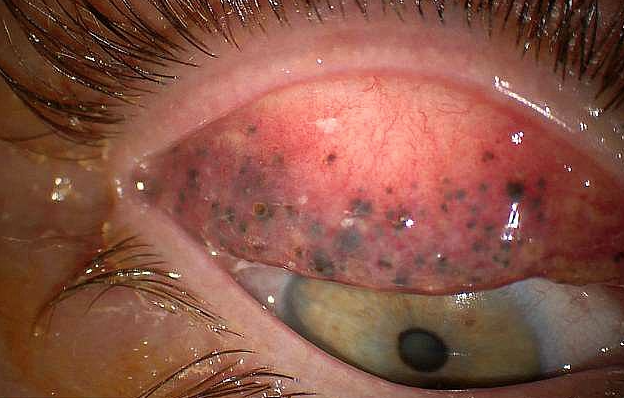 Tam 25 yıl boyunca gözündeki maskarasını temizlemedi bu görüntüler korkunç! - Resim: 4