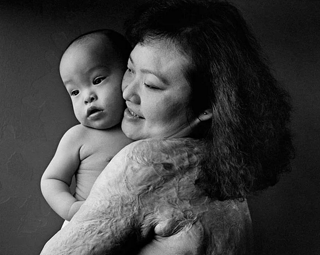 Vietnam Savaşı'nın Simgesi Kim Phuc - Resim: 3