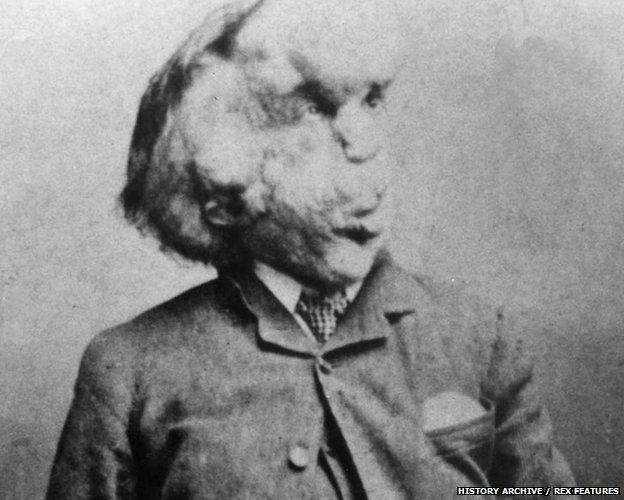 Fil Adam Joseph Merrick'in mezarının bulunduğu iddia edildi - Resim: 1