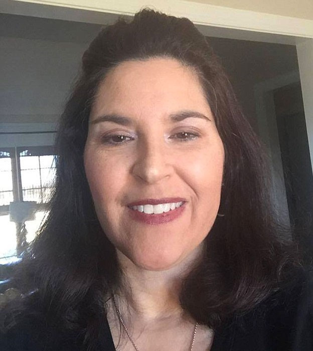 Vücudu taşlaşıyor heykele dönüşüyor inanılmaz! - Resim: 1