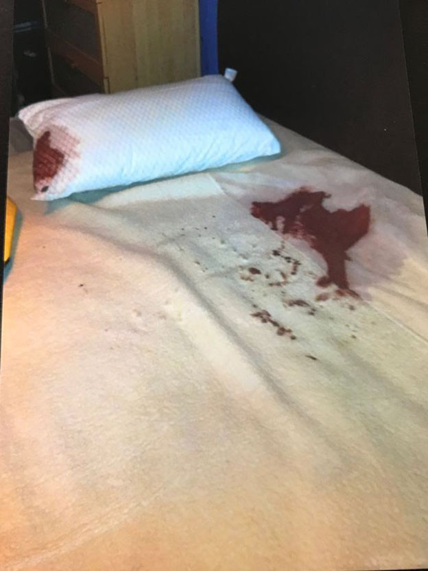 Adam internette tanıştığı adamla otele gitti sonra onu üzerinde buldu ve... - Resim: 4