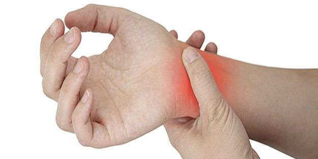 Sinir sıkışması belirtileri sinir sıkışması neden olur? - Resim: 3