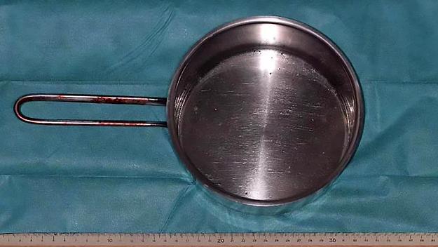 Mutfakta yere düştü gözüne tencere saplandı akıllara zarar olay! - Resim: 4