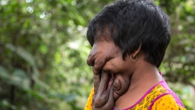 Genç kızın yüzüne bakan donup kalıyor - Resim: 1