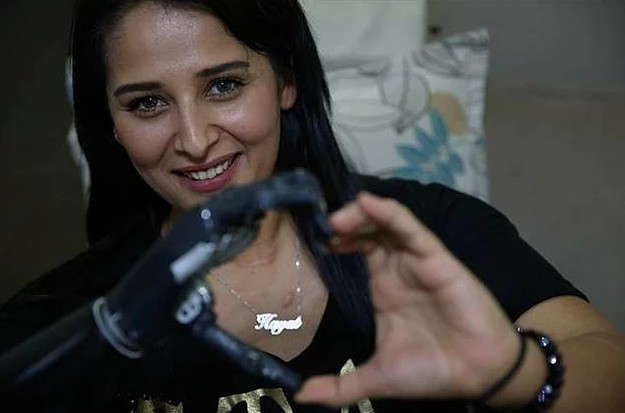 Yok böyle hayat hikayesi ilham alacaksınız - Resim: 4