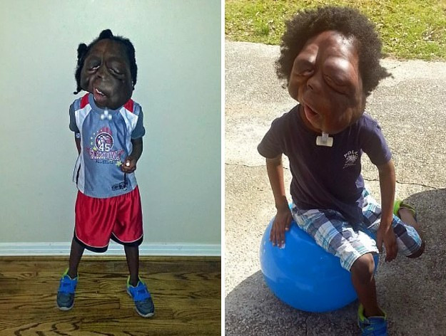 Sadece 8 yaşında ama... Yıllardır tümörle mücadele ediyor - Resim: 4