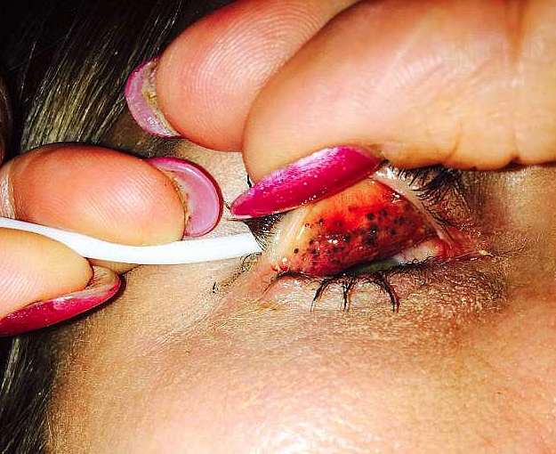 Tam 25 yıl boyunca gözündeki maskarasını temizlemedi bu görüntüler korkunç! - Resim: 3