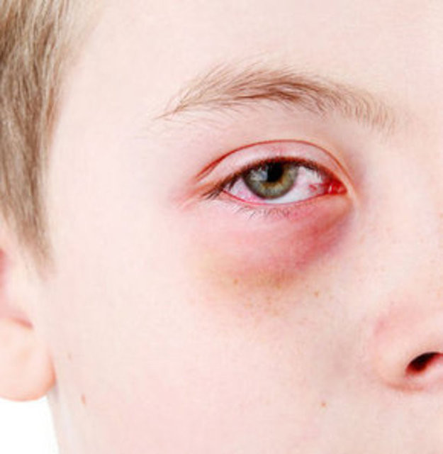 Çocuklarınızda bu belirtiler varsa dikkat - Resim: 3