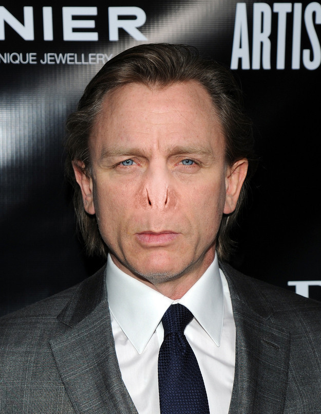 Ünlülerin burunlarına küçük bir dokunuş! - Resim: 3