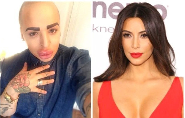 Kim Kardashian'a benzemek için servet harcadı sonuç... - Resim: 3