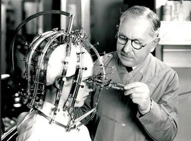 İşkence aleti değil güzellik yöntemi! - Resim: 4