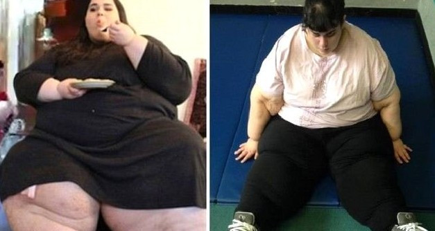 Ölmesi beklenirken tam 120 kilo verdi! Mucizeye bakın... - Resim: 4