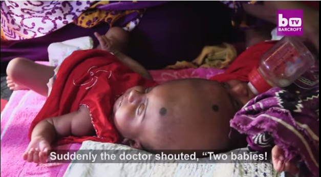 Bebekler öyle bir doğdu ki... Aile durumdan habersiz! - Resim: 4