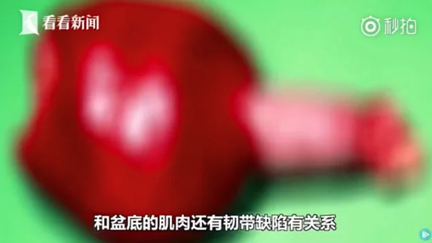 Telefonla tuvalette 30 dakikadan fazla kaldı sonra öyle bir şey oldu ki - Resim: 4