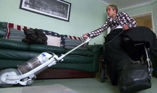 Bu kadının tek bacağı 107 kilo! - Resim: 3