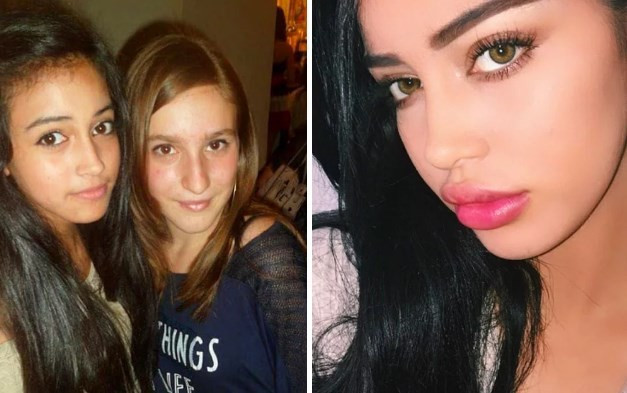 Fenomen olmak için estetik yaptırıyorlar - Resim: 1