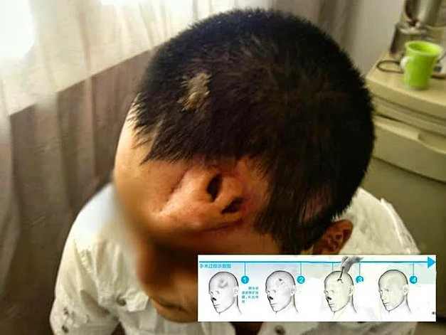 Trafik kazasında burnunu kaybetti doktorlar bunu yaptı - Resim: 4