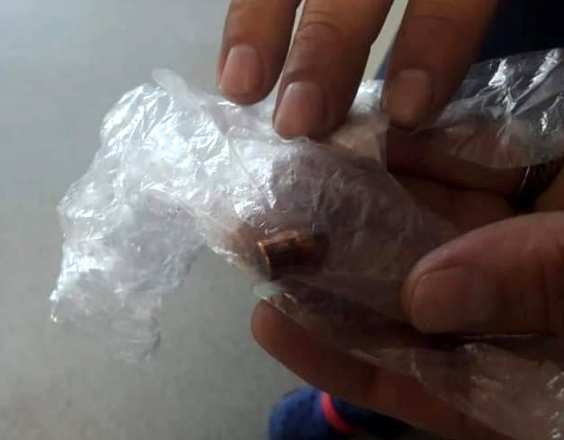 Trabzon'da yaylada gezerken maganda kurşunuyla vuruldu - Resim: 1