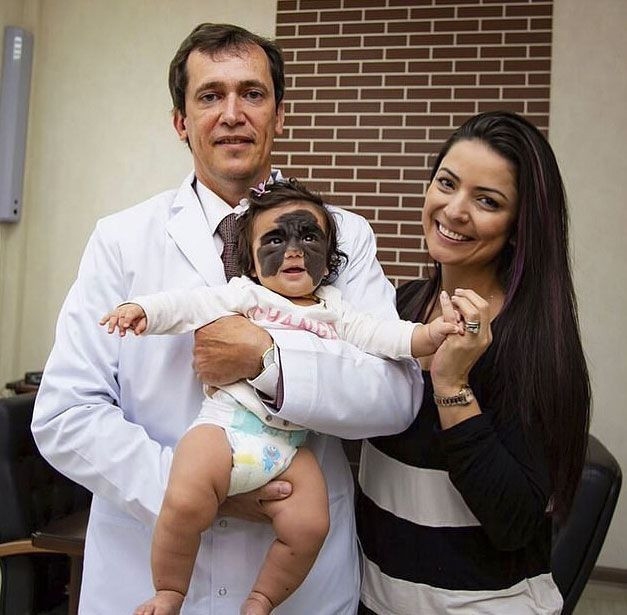 'Batman' maskesi ile doğdu iyileşmesi için on binlerce kişi seferber oldu - Resim: 4