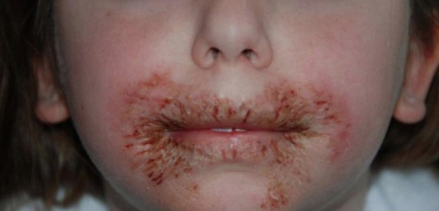 Islak mendille ağzını sildi bu hale geldi! Akılalmaz olay - Resim: 1