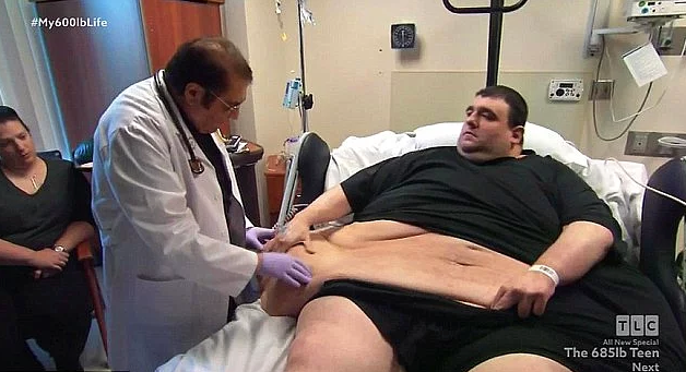 Tam 381 kiloydu Dr. Nowzaradan işi ele aldı ama sonu facia! - Resim: 1