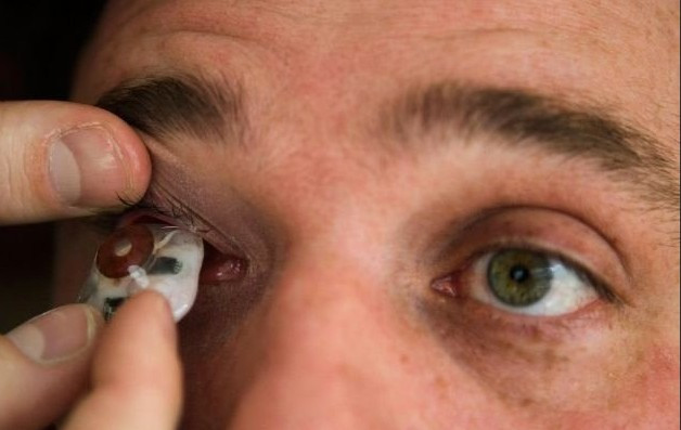 Gözünü çıkarıp yerine öyle birşey yaptı ki... - Resim: 4