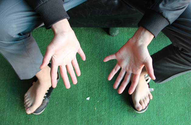 Onun tam 24 parmağı var! Görenler şaşkın - Resim: 1