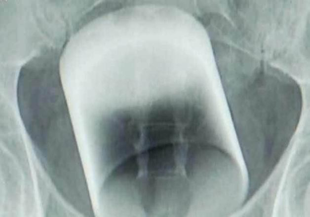 Makatından bardak çıktı akıllara zarar olaya herkes şaştı kaldı - Resim: 1