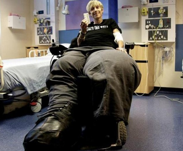 Bu kadının tek bacağı 107 kilo! - Resim: 2