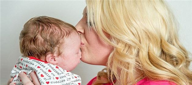 Bebeğin alnını gören şok oluyor - Resim: 2