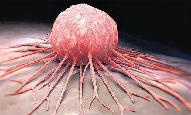 Bu alışkanlıkları bırakın meme kanserine engel olun! - Resim: 2