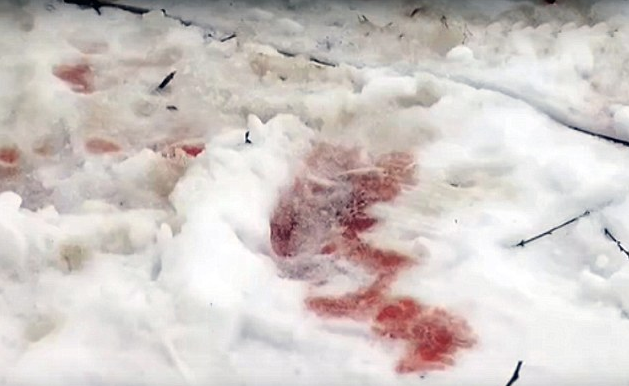 Köpekler 14 yaşındaki kızı parçalayıp yedi görüntüler korkunç! - Resim: 3