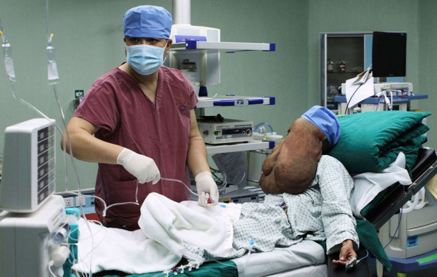 Dünyanın en büyük tümörü - Resim: 3