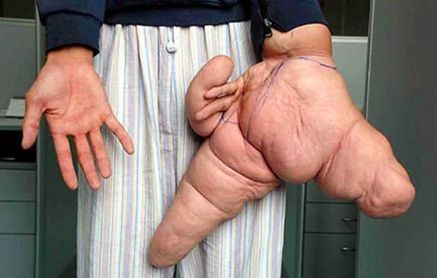 Bu hastalıkların gerçek olduğuna inanmak zor! - Resim: 3