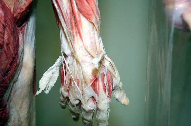 Askıya asılı insan bedenleri! - Resim: 3