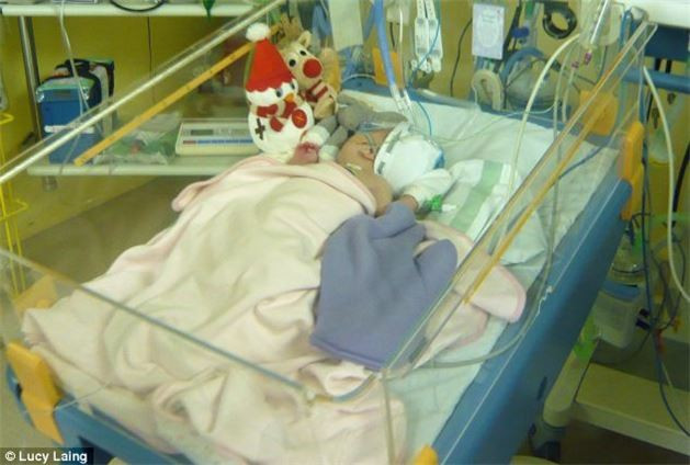 5 yaşında doğum lekelerinden kurtuldu - Resim: 1