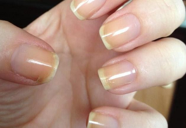 Diş macunu deyip geçmeyin! Bakın tırnaklara sürünce ne oluyor... - Resim: 2