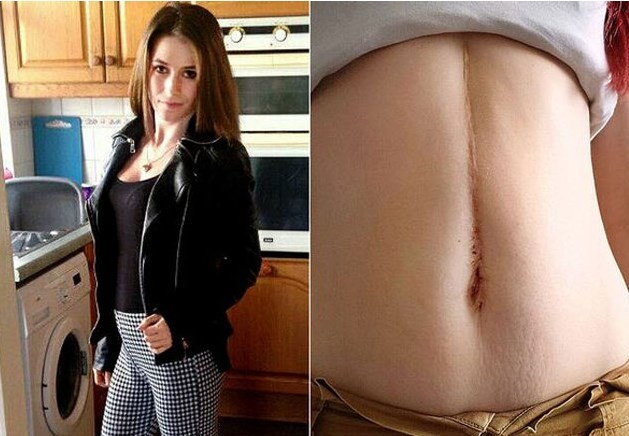 Karnından çıkanlar şok etti - Resim: 1