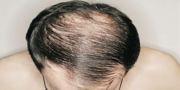 Sadece kadınlar mı yapıyor sandınız? - Resim: 3