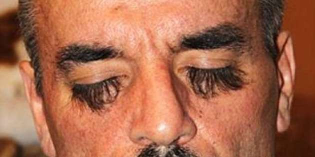 Dünyanın en uzun kirpikli insanı! - Resim: 3