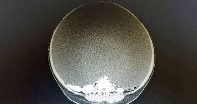 Doktorlar kadının karnını görünce inanamadı - Resim: 2
