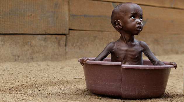 Somali'deki insanlık dramı! - Resim: 1