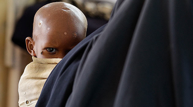 Somali'deki insanlık dramı - Resim: 2